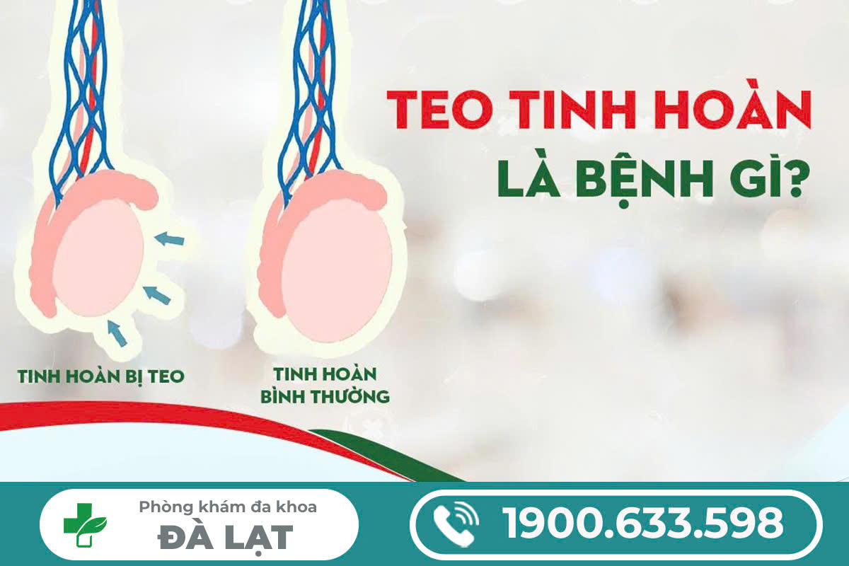 Hình ảnh minh họa